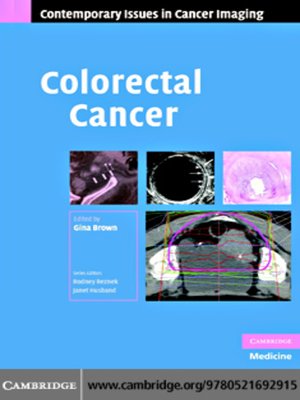 cover image of Colorectal Cancer